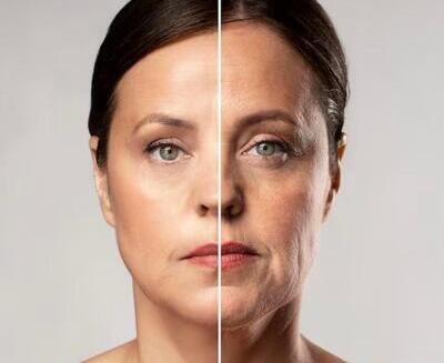 Resultados de el rostro de una mujer dividido por la mitad, mostrando una piel más tersa y joven a la izquierda y una piel más vieja y arrugada a la derecha, lo que pone de relieve los efectos del envejecimiento.
