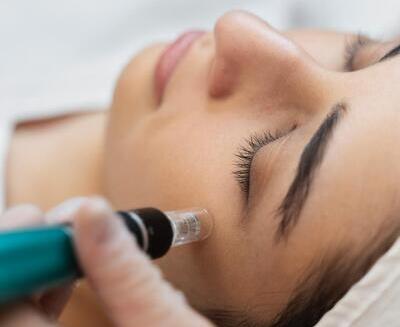 Una persona recibe un tratamiento facial de micropunción con un pequeño dispositivo que se aplica en la piel cerca del pómulo.