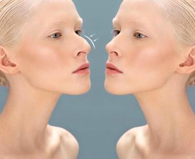 Dos mujeres de rasgos similares se miran de cerca sobre un fondo azul; una de ellas parece pinchar la nariz de la otra, lo que se indica con líneas dibujadas.