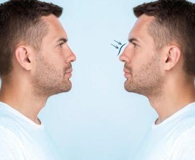 Dos hombres de aspecto similar se enfrentan; uno tiene un pequeño dibujo de un insecto volador cerca de la nariz.